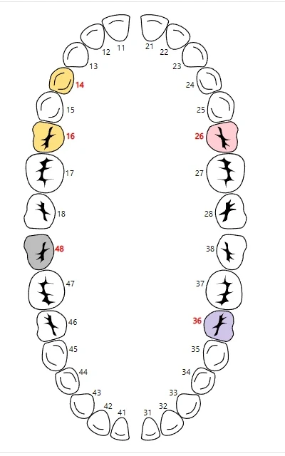 Tooth chart, ready at the chair
